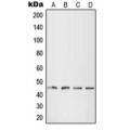 LifeSab™ LHX1 Rabbit pAb (50 µl)