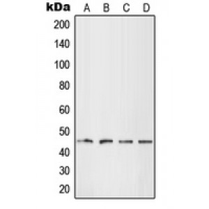LifeSab™ LHX1 Rabbit pAb (50 µl)