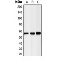 LifeSab™ Hepatic Lipase Rabbit pAb (50 µl)