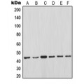 LifeSab™ MCL1 Rabbit pAb (50 µl)