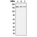 LifeSab™ ASK1 Rabbit pAb (50 µl)