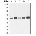 LifeSab™ MMP14 Rabbit pAb (50 µl)