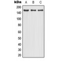 LifeSab™ CD206 Rabbit pAb (50 µl)