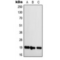 LifeSab™ NBL1 Rabbit pAb (50 µl)