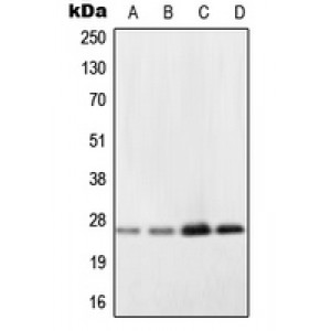 LifeSab™ NDUFV2 Rabbit pAb (50 µl)