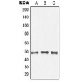 LifeSab™ IKB beta (pT19) Rabbit pAb (50 µl)