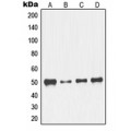 LifeSab™ NFYC Rabbit pAb (50 µl)