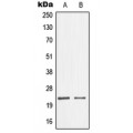 LifeSab™ nm23-H1 Rabbit pAb (50 µl)