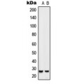 LifeSab™ SIX6 Rabbit pAb (50 µl)