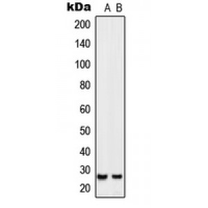 LifeSab™ SIX6 Rabbit pAb (50 µl)