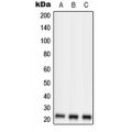 LifeSab™ RKIP Rabbit pAb (50 µl)