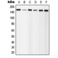 LifeSab™ PLC gamma 1 (pY1253) Rabbit pAb (50 µl)