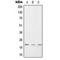 LifeSab™ RGS1 Rabbit pAb (50 µl)