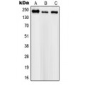 LifeSab™ Nav1.1 Rabbit pAb (50 µl)