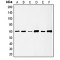 LifeSab™ c-SRC (pS75) Rabbit pAb (50 µl)