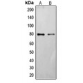 LifeSab™ Frizzled 6 Rabbit pAb (50 µl)