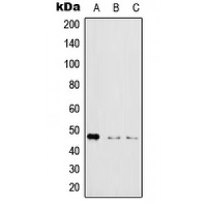LifeSab™ IKK gamma (pS31) Rabbit pAb (50 µl)