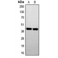 LifeSab™ STK17B Rabbit pAb (50 µl)