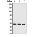 LifeSab™ TRIP13 Rabbit pAb (50 µl)