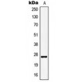 LifeSab™ KCNMB2 Rabbit pAb (50 µl)