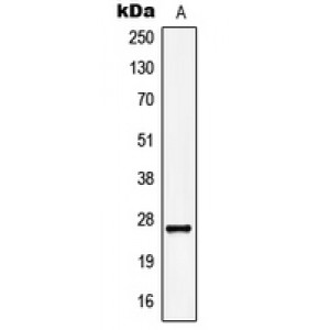LifeSab™ KCNMB2 Rabbit pAb (50 µl)