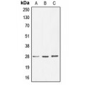 LifeSab™ BRMS1 Rabbit pAb (50 µl)