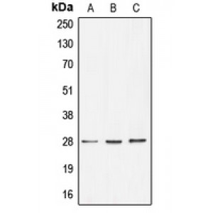 LifeSab™ BRMS1 Rabbit pAb (50 µl)