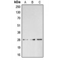 LifeSab™ BRMS1 Rabbit pAb (50 µl)