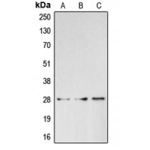 LifeSab™ BRMS1 Rabbit pAb (50 µl)