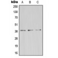 LifeSab™ ZDHHC9 Rabbit pAb (50 µl)