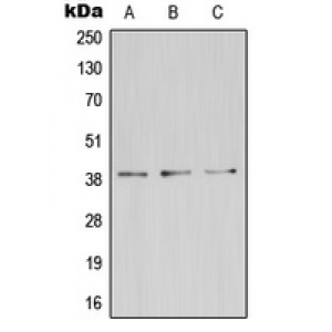 LifeSab™ ZDHHC9 Rabbit pAb (50 µl)