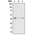 LifeSab™ A4GNT Rabbit pAb (50 µl)