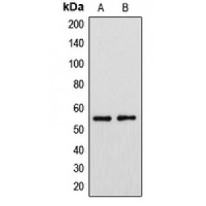 LifeSab™ Cytochrome P450 39A1 Rabbit pAb (50 µl)