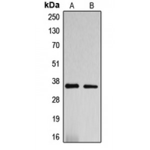 LifeSab™ DNAJC17 Rabbit pAb (50 µl)
