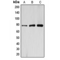 LifeSab™ ARHGAP22 Rabbit pAb (50 µl)