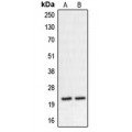 LifeSab™ CHP2 Rabbit pAb (50 µl)