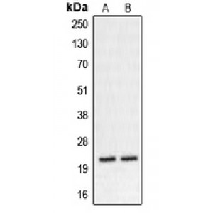 LifeSab™ CHP2 Rabbit pAb (50 µl)