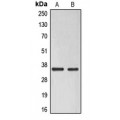 LifeSab™ ELOVL6 Rabbit pAb (50 µl)