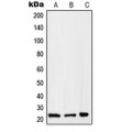 LifeSab™ RAB2B Rabbit pAb (50 µl)