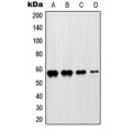 LifeSab™ ZNF682 Rabbit pAb (50 µl)