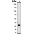 LifeSab™ RIMKLA Rabbit pAb (50 µl)