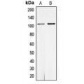 LifeSab™ Androgen Receptor (pS650) Rabbit pAb (50 µl)