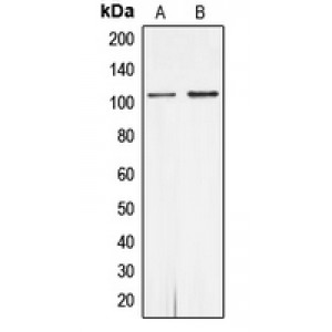 LifeSab™ Androgen Receptor (pS650) Rabbit pAb (50 µl)