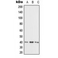 LifeSab™ Adenosine Kinase Rabbit pAb (50 µl)