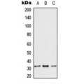 LifeSab™ ANT3 Rabbit pAb (50 µl)