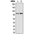 LifeSab™ APBA2 Rabbit pAb (50 µl)