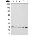 LifeSab™ CD298 Rabbit pAb (50 µl)