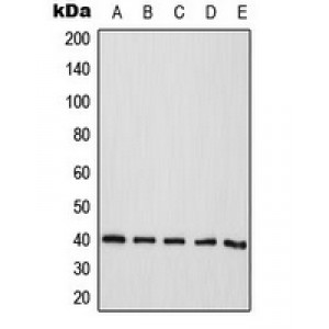 LifeSab™ CD298 Rabbit pAb (50 µl)