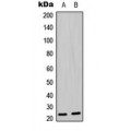 LifeSab™ BAD (pS136) Rabbit pAb (50 µl)
