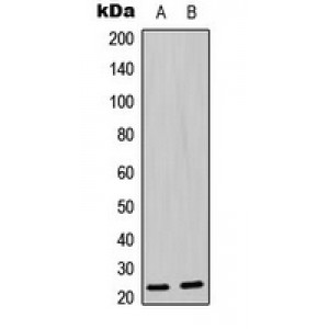 LifeSab™ BAD (pS136) Rabbit pAb (50 µl)